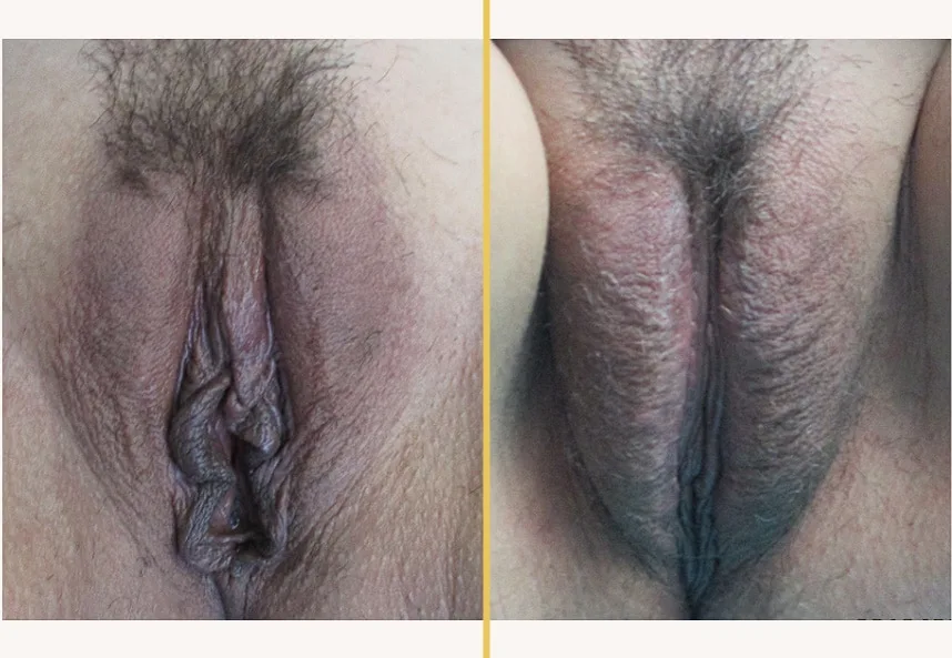 Case 0226