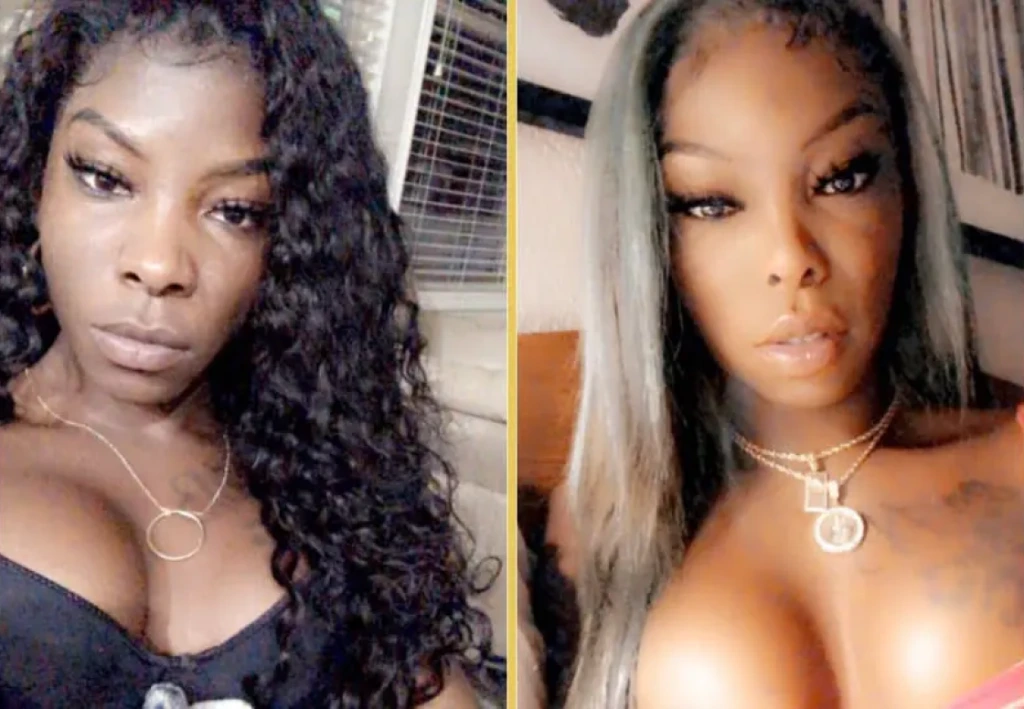 What Is Facial Feminization Surgery Banner