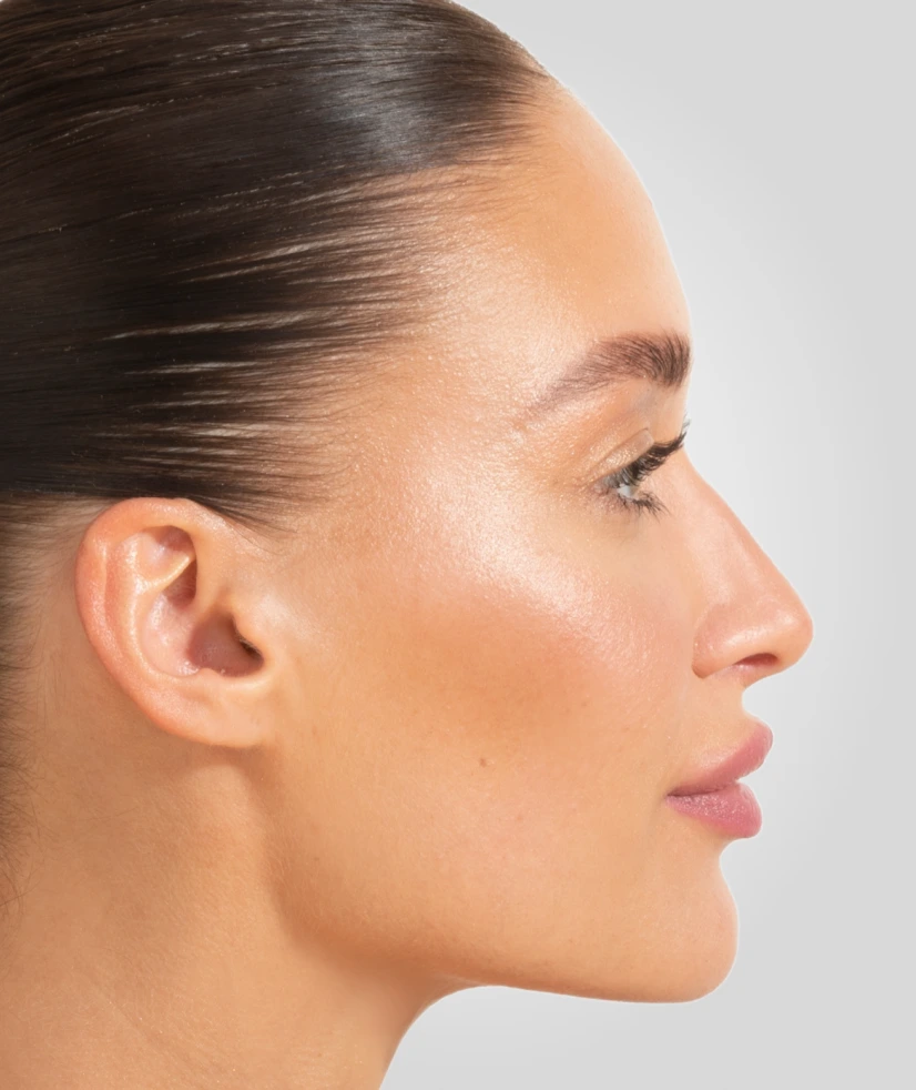 Facial Surgery in Novi, Michigan: Rhinoplasty (Nose Surgery) Banner