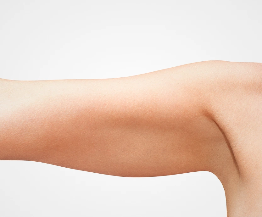 What Is Revision Breast Reduction Novi, MI Banner